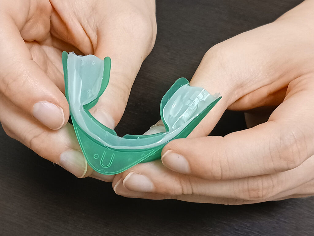 ホワイトニングで使用するトレイの写真
