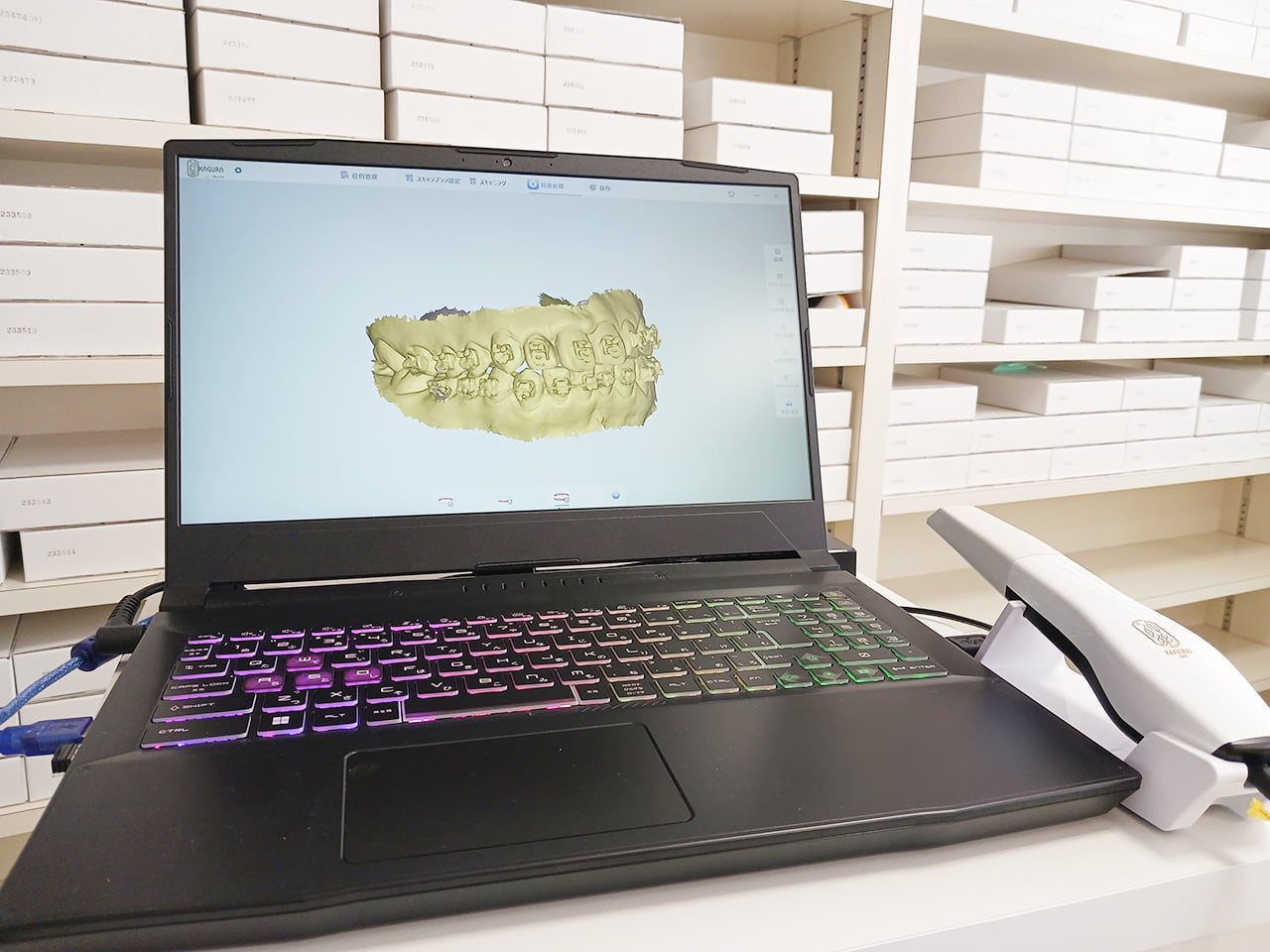 クジライ矯正歯科で使用している歯科3Dスキャナーの写真