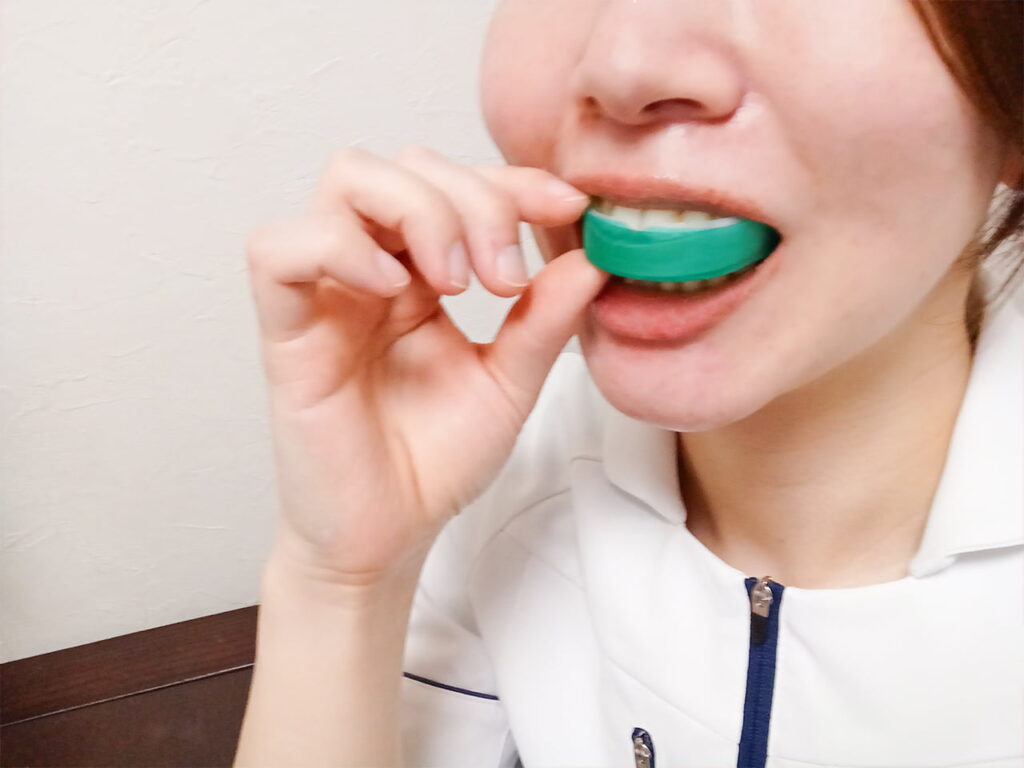 ホワイトニングを使用している参考写真